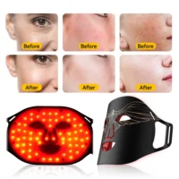 kf Se461c1d0055b413c901dfe9a5ee2ed9dM Lescolton New Red Led Light Therapy Infrared Flexible Soft Mask Silicone 4 Color Led Therapy Anti